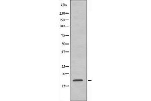 Western blot analysis of extracts from Jurkat cells, using RPS15 antibody. (RPS15 anticorps  (C-Term))