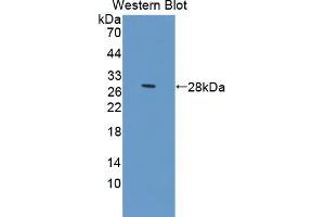 Western blot analysis of the recombinant protein. (Prolactin Receptor anticorps  (AA 25-234))