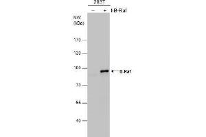 WB Image B-Raf antibody [N2C1], Internal detects B-Raf protein by western blot analysis.