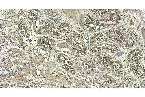 (ABIN6391349) (4 μg/mL) staining of paraffin embedded Human Testis. (PPP1R12A anticorps  (C-Term))