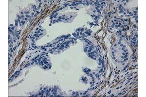 Immunohistochemical staining of paraffin-embedded Human prostate tissue using anti-ERBB2 mouse monoclonal antibody.
