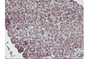 Image no. 10 for anti-Interferon Regulatory Factor 6 (IRF6) antibody (ABIN1498901)