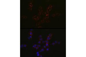 Immunofluorescence analysis of Jurkat cells using CCR5 Rabbit pAb (ABIN7266307) at dilution of 1:50 (40x lens).