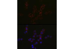 Immunofluorescence analysis of Jurkat cells using CCR5 Rabbit pAb (ABIN7266307) at dilution of 1:50 (40x lens). (CCR5 anticorps  (AA 100-200))