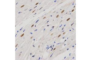 Immunohistochemistry (IHC) image for anti-Proline-, Glutamic Acid- and Leucine-Rich Protein 1 (PELP1) (AA 1021-1180) antibody (ABIN3023502) (PELP1 anticorps  (AA 1021-1180))