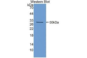 Western blot analysis of the recombinant protein. (Kallikrein 13 anticorps  (AA 25-261))