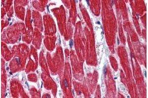 Human Heart: Formalin-Fixed, Paraffin-Embedded (FFPE)