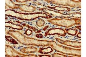 Immunohistochemistry of paraffin-embedded human kidney tissue using ABIN7171209 at dilution of 1:100 (SNCAIP anticorps  (AA 309-553))