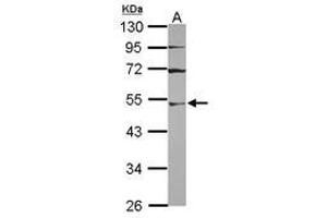 Image no. 1 for anti-Ubiquitin-Like Modifier Activating Enzyme 3 (UBA3) (AA 1-229) antibody (ABIN1501609) (UBA3 anticorps  (AA 1-229))