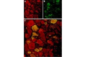 Expression of TRPV4 in rat DRG - Immunohistochemical staining of rat dorsal root ganglion (DRG) frozen sections using Anti-TRPV4 Antibody (ABIN7043850, ABIN7043994 and ABIN7043995).