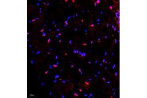 Immunofluorescence of paraffin embedded mouse heart using SMNDC1 (ABIN7075773) at dilution of 1:650 (400x lens) (SMNDC1 anticorps)