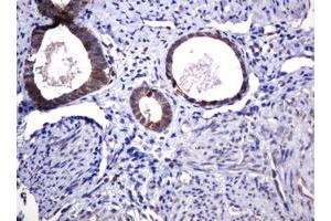 Image no. 5 for anti-Pogo Transposable Element with KRAB Domain (POGK) antibody (ABIN1500329)