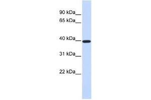 XRCC4 antibody used at 1 ug/ml to detect target protein. (XRCC4 anticorps  (Middle Region))