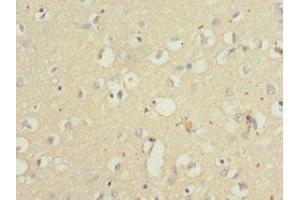 Immunohistochemistry of paraffin-embedded human brain tissue using ABIN7166001 at dilution of 1:100 (QKI anticorps  (AA 1-341))