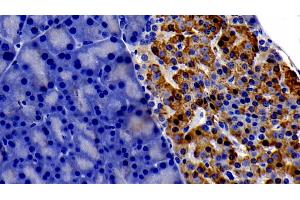 Detection of gp130 in Rat Pancreas Tissue using Polyclonal Antibody to Glycoprotein 130 (gp130)