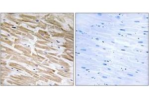 Immunohistochemistry analysis of paraffin-embedded human heart tissue, using NEURL2 Antibody.