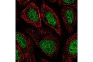 Immunofluorescent staining of SiHa cells with GTF2H3 polyclonal antibody  (Green) shows positivity in nucleus but excluded from the nucleoli.