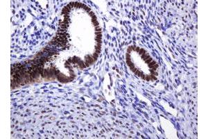 Image no. 7 for anti-Decapping Enzyme, Scavenger (DCPS) antibody (ABIN1497781)