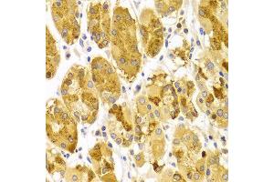 Immunohistochemistry of paraffin-embedded Human gastric using PRKCE antibody at dilution of 1:100 (x400 lens).