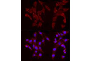 Immunofluorescence analysis of NIH/3T3 cells using Perilipin-2 Rabbit pAb (ABIN6127414, ABIN6145773, ABIN6145774 and ABIN6221871) at dilution of 1:50 (40x lens).