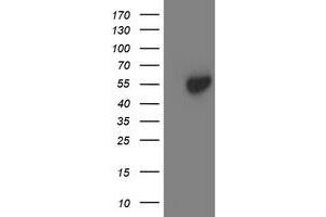 Western Blotting (WB) image for anti-Aminoacylase 1 (ACY1) antibody (ABIN1496452) (Aminoacylase 1 anticorps)