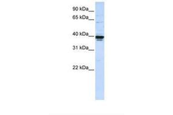 ETV3L anticorps  (AA 252-301)