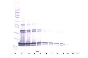 Image no. 1 for anti-Tumor Necrosis Factor (Ligand) Superfamily, Member 13b (TNFSF13B) antibody (ABIN465048) (BAFF anticorps)