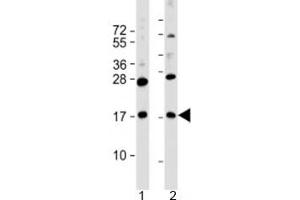 Western blot testing of human 1) MKN45 and 2) PANC-1 cell lysate with FAM159B antibody at 1:2000. (FAM159B anticorps  (AA 121-154))