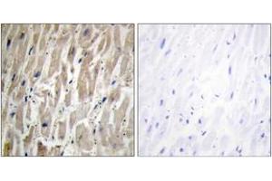 Immunohistochemistry analysis of paraffin-embedded human heart tissue, using Cytochrome P450 2J2 Antibody.