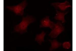 ABIN6276816 staining HeLa by IF/ICC. (POU2F1 anticorps  (Internal Region))