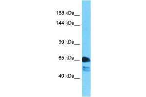 Host:  Rabbit  Target Name:  ATP7B  Sample Type:  Lung Tumor lysates  Antibody Dilution:  1.