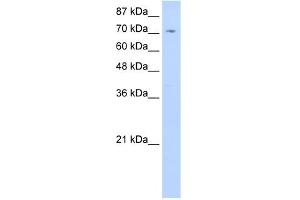 WB Suggested Anti-ZNF214 Antibody Titration:  0. (ZNF214 anticorps  (C-Term))