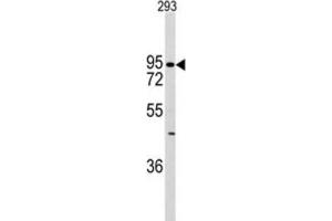 Western Blotting (WB) image for anti-K-Cadherin (CDH6) antibody (ABIN2997777)