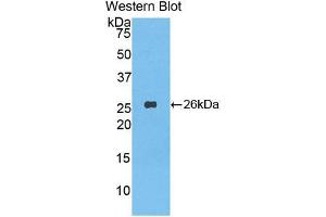 Western blot analysis of the recombinant protein. (LAP anticorps  (AA 320-519))
