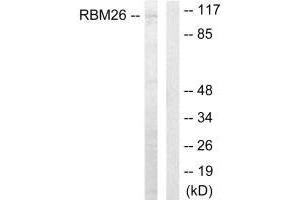Western blot analysis of extracts from Jurkat cells, using RBM26 antibody. (RBM26 anticorps  (C-Term))