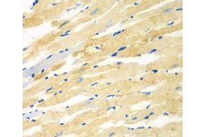 Immunohistochemistry of paraffin-embedded Rat heart using PDE4DIP Polyclonal Antibody at dilution of 1:100 (40x lens). (PDE4DIP anticorps)