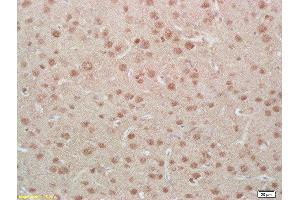 Formalin-fixed and paraffin embedded rat brain labeled with Anti-Phospho-MEF2A (Ser408)Polyclonal Antibody, Unconjugated  at 1:200, followed by conjugation to the secondary antibody and DAB staining (MEF2A anticorps  (pSer408))