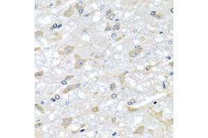 Immunohistochemistry of paraffin-embedded rat brain using RPLP1 antibody (ABIN5974064) at dilution of 1/100 (40x lens). (RPLP1 anticorps)