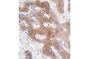 Immunohistochemistry (IHC) image for anti-Cytochrome P450, Family 3, Subfamily A, Polypeptide 5 (CYP3A5) antibody (ABIN3003497)