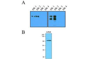 Western Blotting (WB) image for anti-Hexokinase 2 (HK2) (AA 1-917), (N-Term) antibody (ABIN263918) (Hexokinase 2 anticorps  (N-Term))