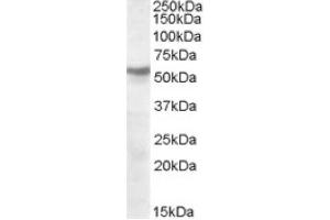 Image no. 1 for anti-Nicotinic Acetylcholine Receptor beta (CHRNB1) (Internal Region), (Subunit beta) antibody (ABIN374964) (CHRNB1 anticorps  (Internal Region, Subunit beta))