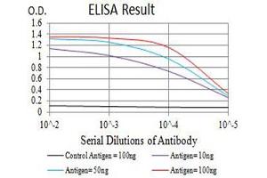 Black line: Control Antigen (100 ng),Purple line: Antigen (10 ng), Blue line: Antigen (50 ng), Red line:Antigen (100 ng)