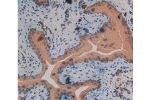 Used in DAB staining on fromalin fixed paraffin- embedded spermaduct tissue (PKC delta anticorps  (AA 328-674))