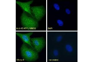 ABIN184893 Immunofluorescence analysis of paraformaldehyde fixed U2OS cells, permeabilized with 0. (UBE2S anticorps  (N-Term))