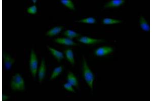 Immunofluorescence staining of Hela Cells with ABIN7127323 at 1:50, counter-stained with DAPI. (Recombinant ADAM17 anticorps)