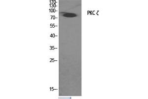Western Blotting (WB) image for anti-Protein Kinase C, zeta (PRKCZ) (Thr560) antibody (ABIN5957396)