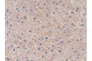 Detection of VEGFA in Human Liver Tissue using Polyclonal Antibody to Vascular Endothelial Growth Factor A (VEGFA)