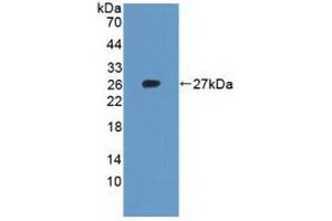 Figure. (RPL23A anticorps  (AA 2-156))