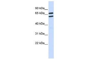 WB Suggested Anti-TRIML1 Antibody Titration:  0. (TRIML1 anticorps  (Middle Region))