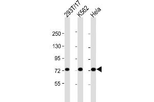 All lanes : Anti-MYBL2 Antibody (C-Term) at 1:2000 dilution Lane 1: 293T/17 whole cell lysate Lane 2: K562 whole cell lysate Lane 3: Hela whole cell lysate Lysates/proteins at 20 μg per lane.
